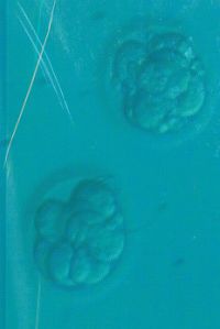 Blastocyst